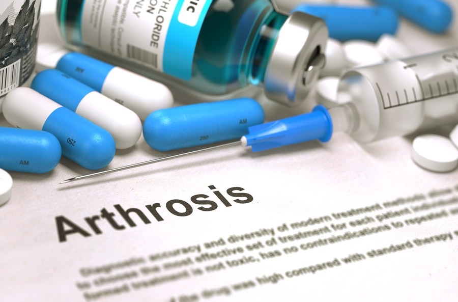 artroza beh ce vitamine vor ajuta la durerea articulară